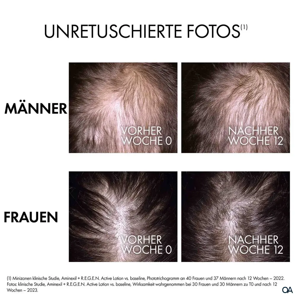 Vichy DERCOS Aminexil Clinical R.E.G.E.N. Booster Serum mit 1,5 % Aminexil bei Haarverlust